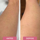 Lixa Removedora de Pelos Cristal Indolor