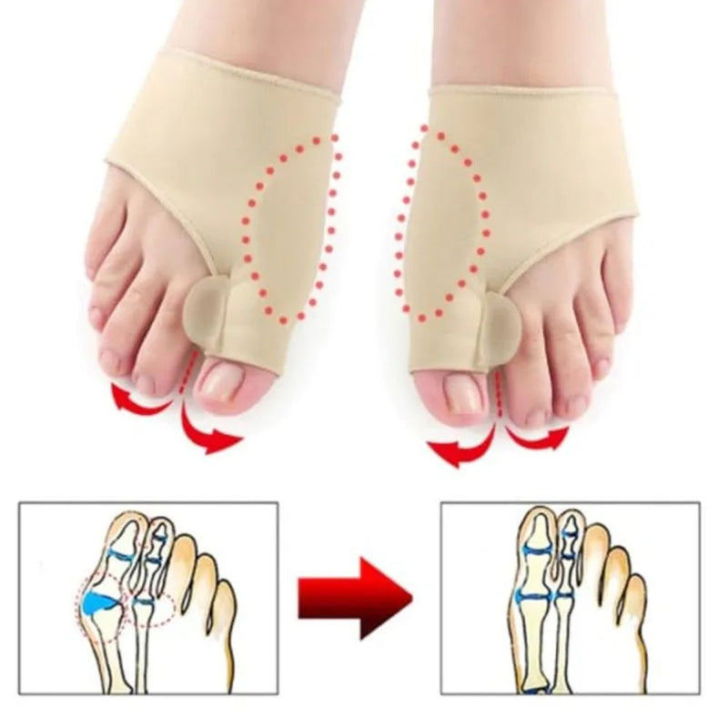 Kit Ortopédico 1 Par de Palmilhas para Fascite Plantar + 1 Par de Meias Protetoras com Separador de Joanetes